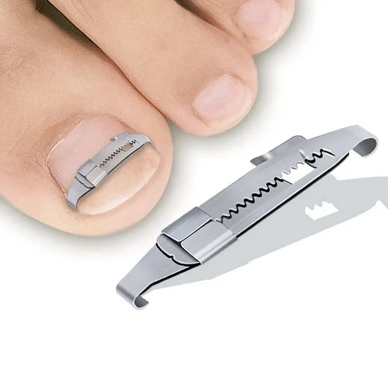 Professional Ingrown Toenail Treatment Corrector