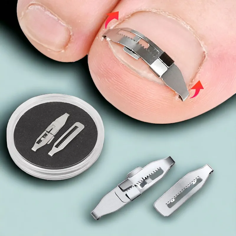 Professional Ingrown Toenail Treatment Corrector